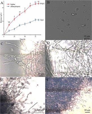 Whole Transcriptome Analysis Provides Insights Into the Molecular Mechanisms of Chlamydospore-Like Cell Formation in Phanerochaete chrysosporium